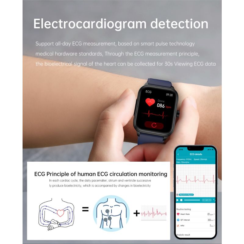 ET540 Chytré hodinky ECG, Krevní Glukóza, Srdeční tep, Tlak, Kyslík, Teplota, Bluetooth Volání, Fitness Tracker