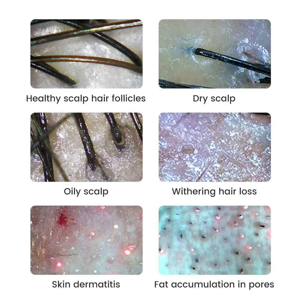500násobné zvětšení Digitální mikroskop 2MP Lupa Oprava elektroniky Video Mince Microscopio Ruční Dermatoskop Přístroj pro analýzu kůže