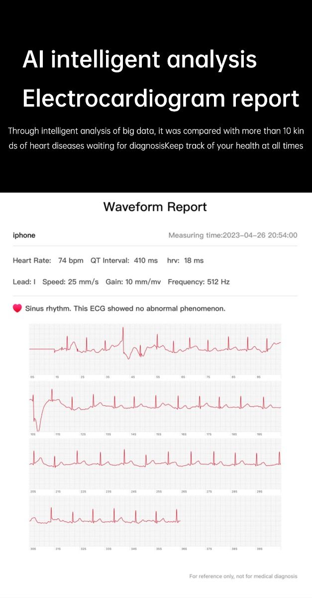 ET540 Krevní glukóza EKG Tělesná teplota Krevní tlak Kyslík v krvi Srdeční tep Bluetooth hovory Chytré hodinky Fitness tracker