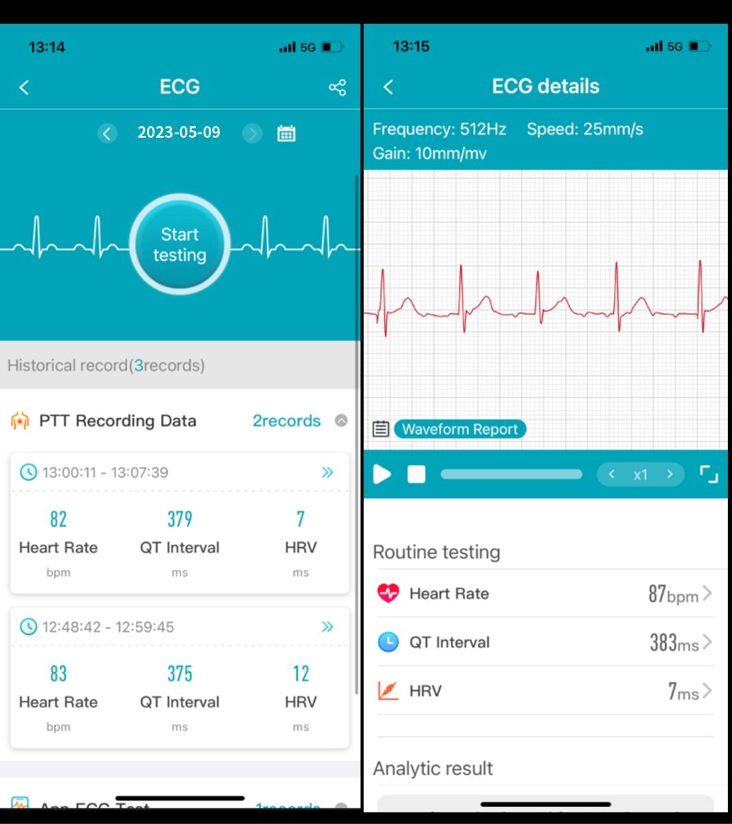 ET540 Krevní glukóza EKG Tělesná teplota Krevní tlak Kyslík v krvi Srdeční tep Bluetooth hovory Chytré hodinky Fitness tracker