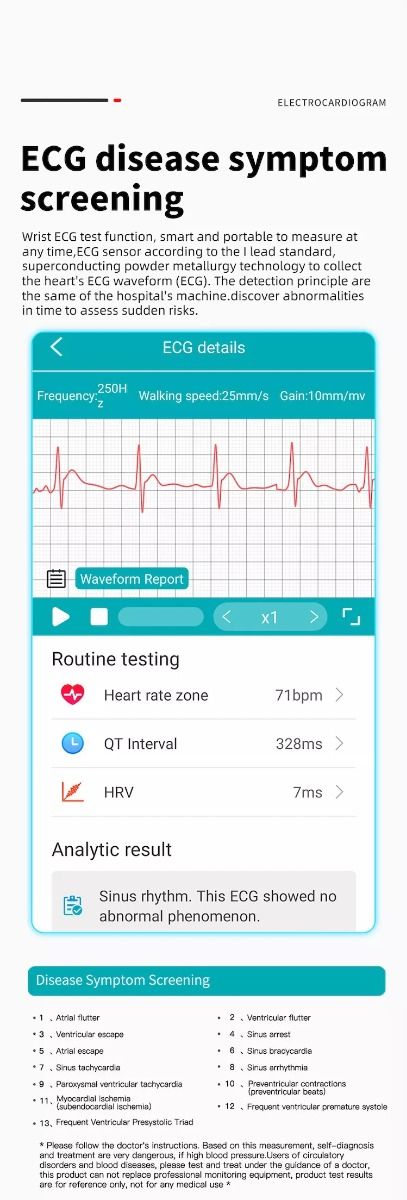 EP02 Chytré hodinky na měření krevního cukru a glukózy, ECG HRV, srdeční tep, teplota, 1,57" HD, voděodolný chytrý náramek, fitness tracker