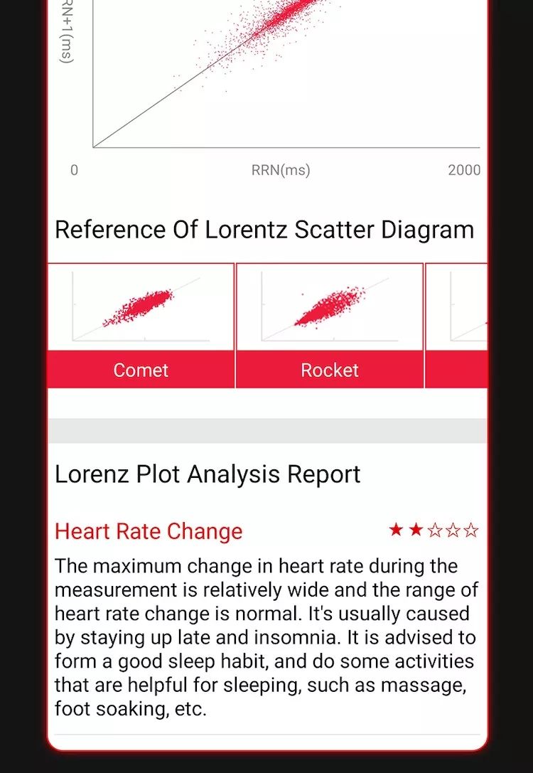 EP02 Chytré hodinky na měření krevního cukru a glukózy, ECG HRV, srdeční tep, teplota, 1,57" HD, voděodolný chytrý náramek, fitness tracker